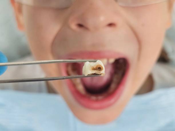 Best Emergency Gum Treatment in Lake Panasoffkee, FL